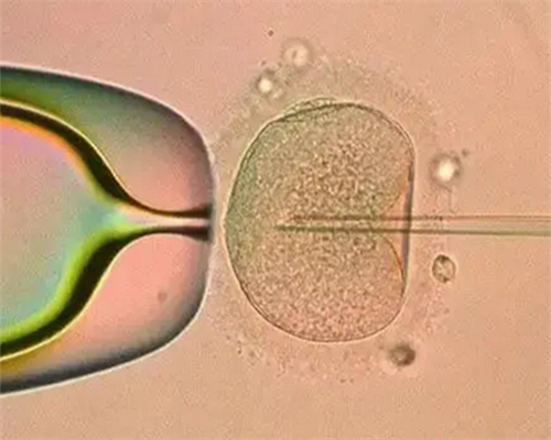 福建省妇幼保健院陈丽主任咨询指南：如何预约与辅助生殖服务